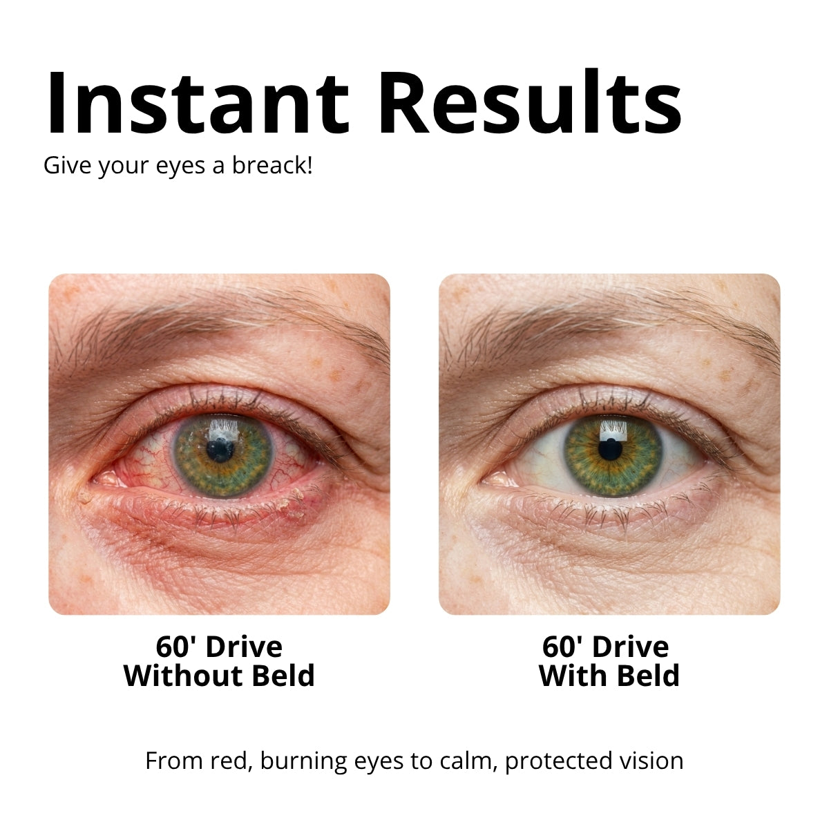 Beld™ DualShield — Dry Eye & Light Sensitivity Glasses