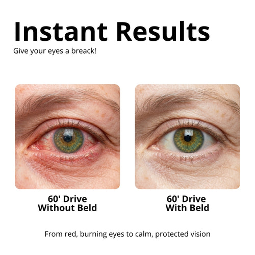 Beld™ DualShield — Dry Eye & Light Sensitivity Glasses